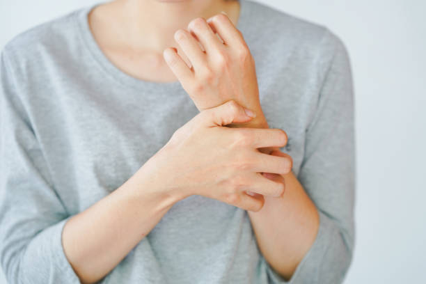 Cara Menghilangkan Panu di Badan secara Efektif dan Alami
